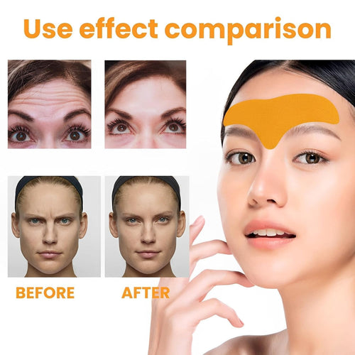 10 Pcs Forehead Wrinkle Patches, Face Wrinkle Patches