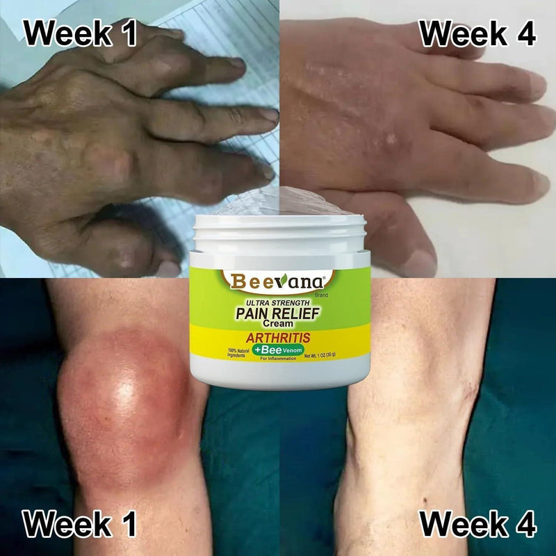 Bee Venom Joint and Bone Therapy Cream (Pack Of 2)