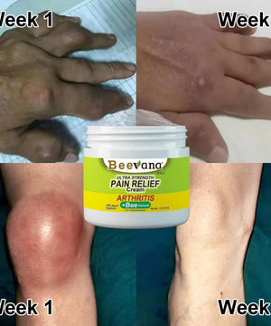 1. Bee Venom Pain Relief Cream