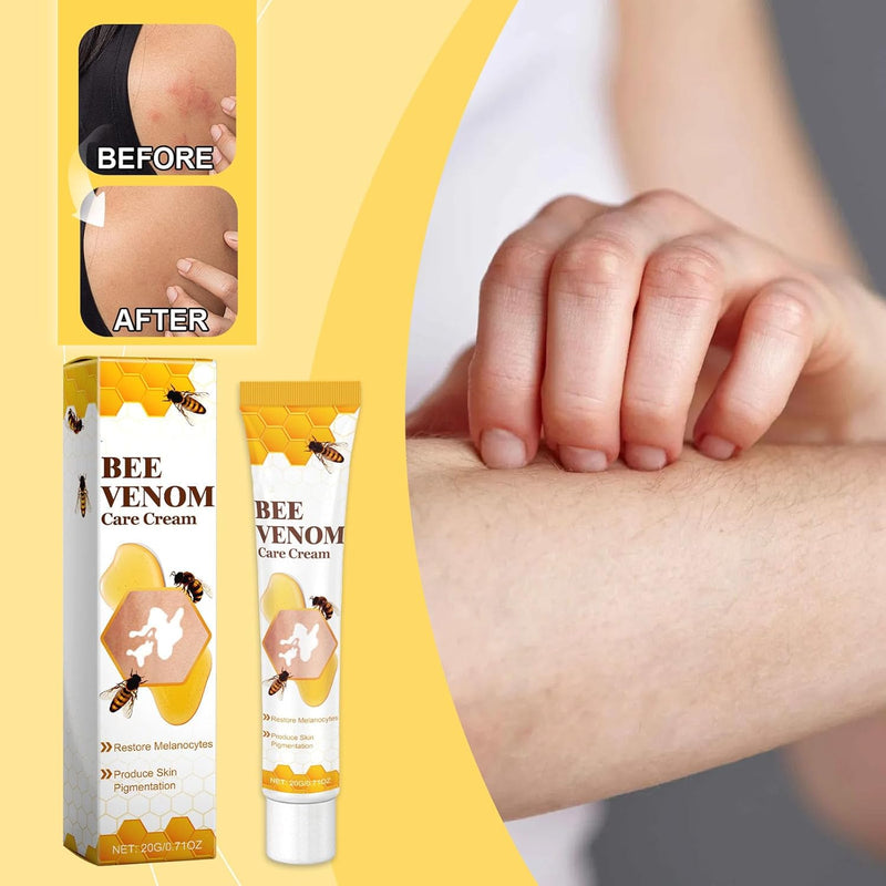 Bee Venom Vitiligo Treatment Cream ( Pack Of 1 )