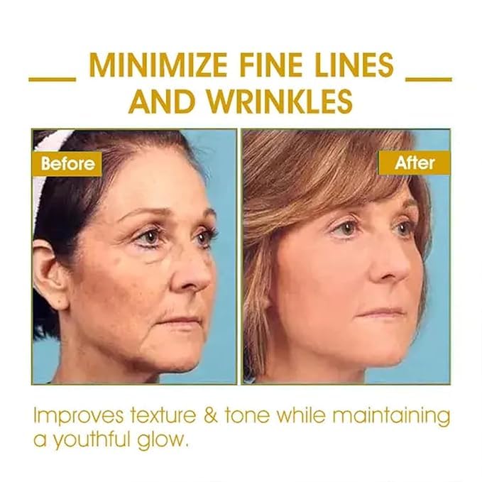 Bee Venom Vitiligo Treatment Cream (Pack of 2)