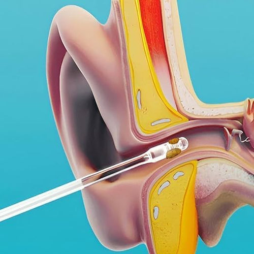 Ear Warning Removal Tool, Earwax Remover for Elderly Adults