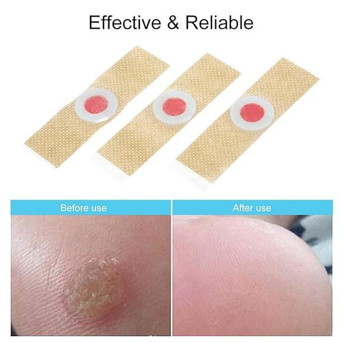 Corn Remover Pads Salicylic Acid