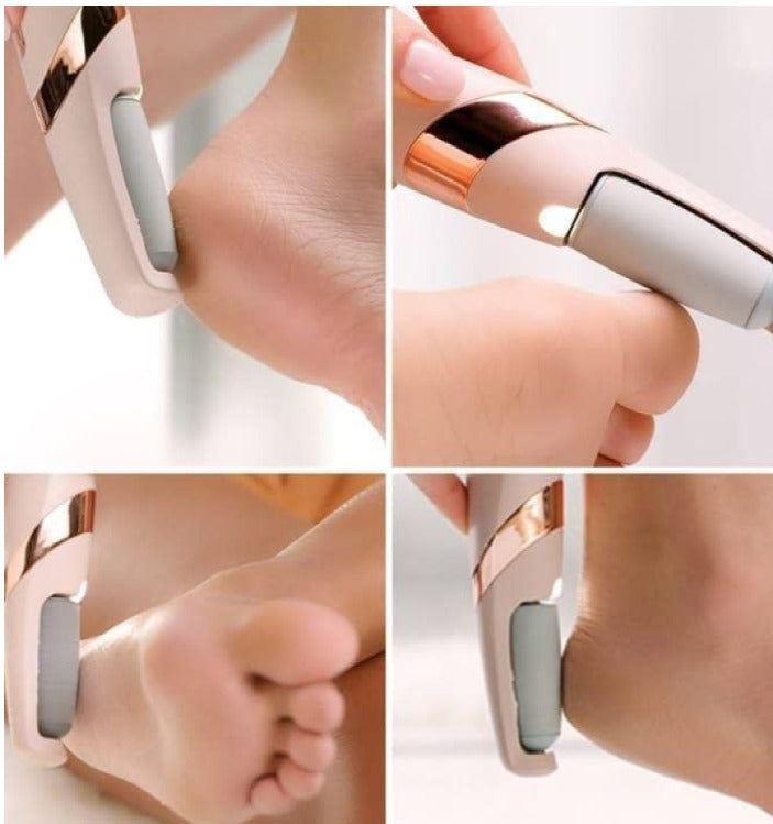 Flawless Pedi Electronic Tool File and Callus Remover, Foot File Callus Remover Tool