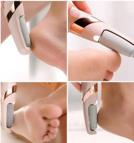 Flawless Pedi Electronic Tool File and Callus Remover, Foot File Callus Remover Tool