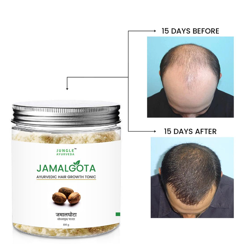 Jamalgota Powder for Hair Growth, Natural Skin & Hair Solution ( Pack Of 2 )