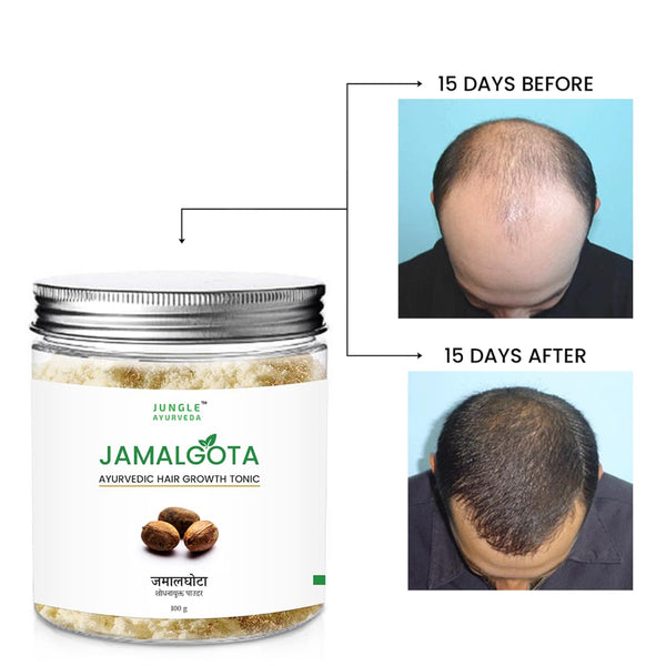 Jamalgota Powder for Hair Growth, Natural Skin & Hair Solution ( Pack Of 2 )