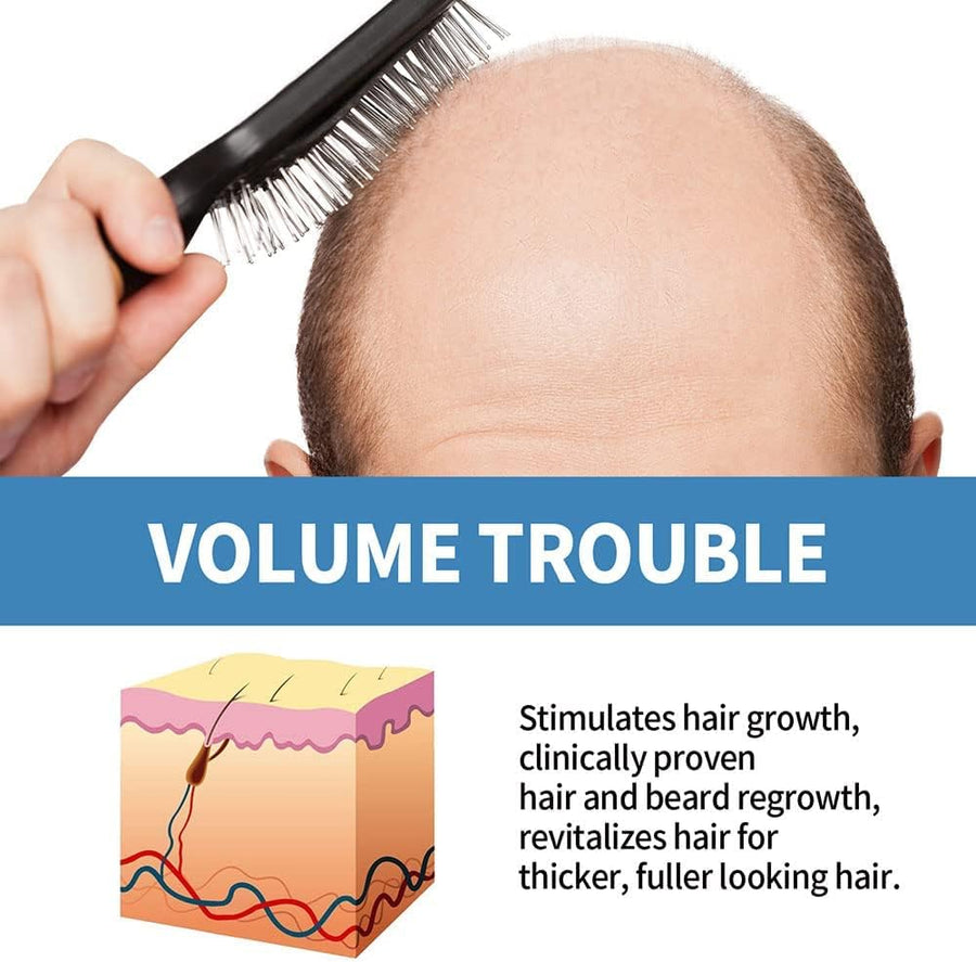 Minoxi Roll-on Hair Treatment, Hair Oil for Dry Damaged Hair and Growth