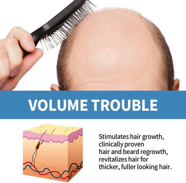 Minoxi Roll-on Hair Treatment, Hair Oil for Dry Damaged Hair and Growth