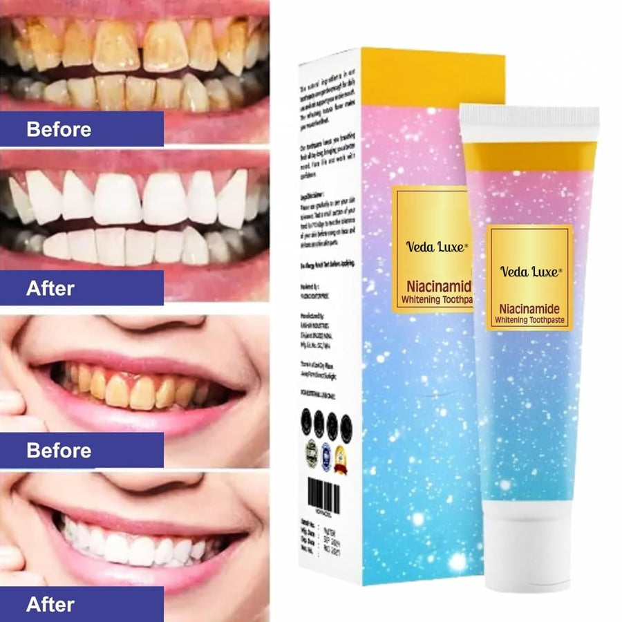 Niacinamide Whitening Toothpaste (PACK OF 1)
