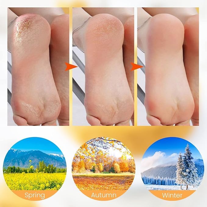 Silicone Gel Moisturizing Socks – Spa Pedicure Socks for Soft, Smooth & Hydrated Feet, Deep Moisture Foot Care Treatment for Dry Cracked Heels, Reusable Gel Socks for Men & Women, Comfortable Slip-On Foot Mask for Home Spa & Daily Skin Care