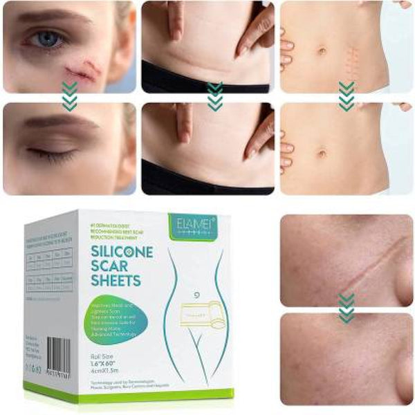 Silicone Scar Sheets Soft Scar Tape for Scar Removal – Flexible Reusable Silicone Gel Pads for Reducing Surgical, Acne, Burn & Stretch Marks, Skin-Friendly Scar Treatment Tape for Men & Women, Comfortable Invisible Scar Care Patch