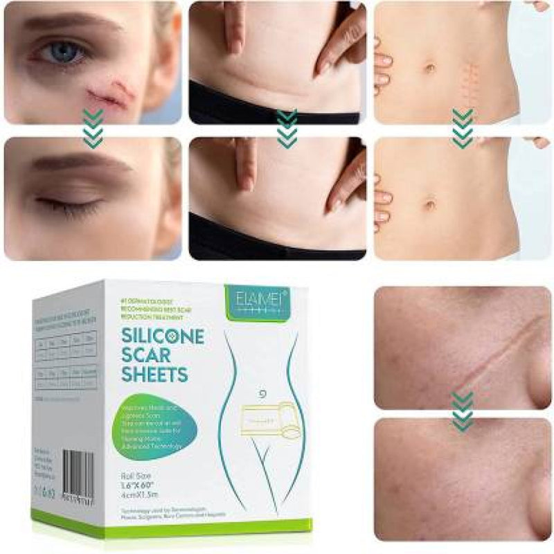 Silicone Scar Sheets Soft Scar Tape for Scar Removal – Flexible Reusable Silicone Gel Pads for Reducing Surgical, Acne, Burn & Stretch Marks, Skin-Friendly Scar Treatment Tape for Men & Women, Comfortable Invisible Scar Care Patch