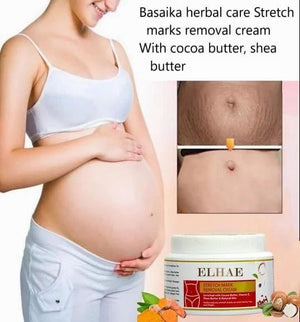 1. Stretch Mark Removal Cream (Pack Of 2)