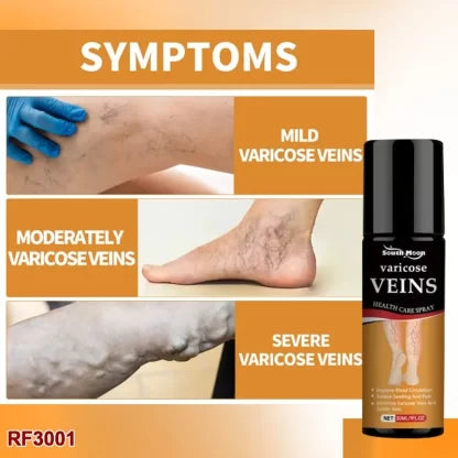 Varicose Veins Spray Natural Herbal Formula for Fast Relief from Spider Veins, Leg Pain, Swelling & Poor Blood Circulation – Cooling Vein Care Treatment for Men & Women (Pack of 2)