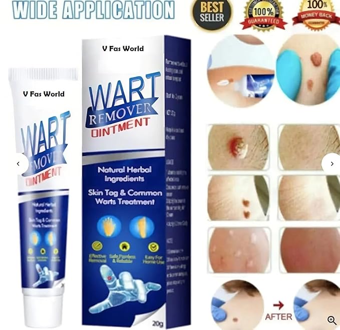 Wart remover ointment for wart removal (Pack of 2)